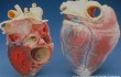 Medizin Herzmuskel mit Pflaster heilen Nachrichten